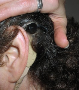 Best this selfie!  My earhook connected to the percutaneous pedestal.