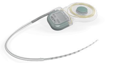 MED-EL SYNCHRONY implant